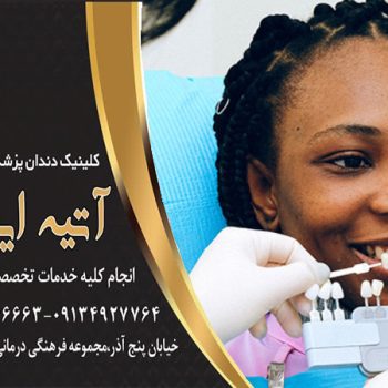 کامپوزیت دندان اصفهان