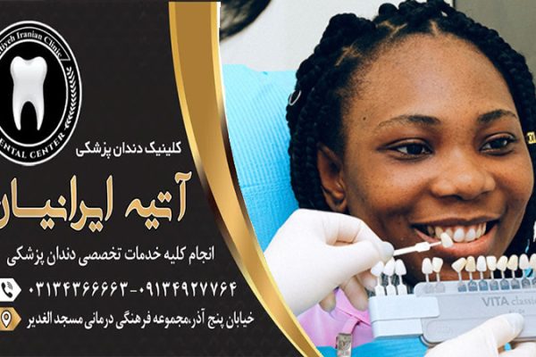کامپوزیت دندان اصفهان
