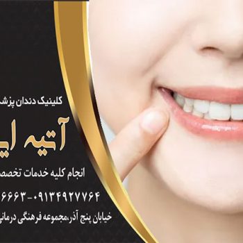 طراحی تخصصی لبخند اصفهان
