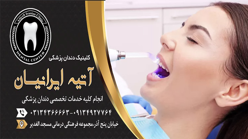ایمپلنت دندان اصفهان