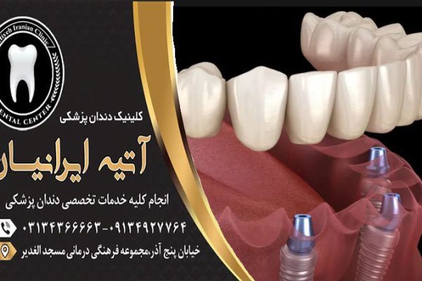 بهترین روش های مراقبت از دندان
