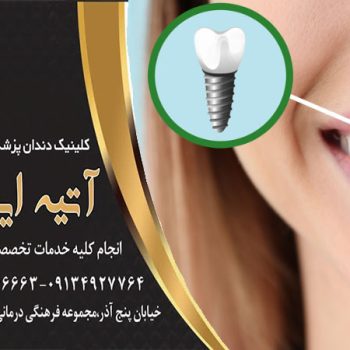 ایمپلنت دندان مناسب چه کسانی است؟