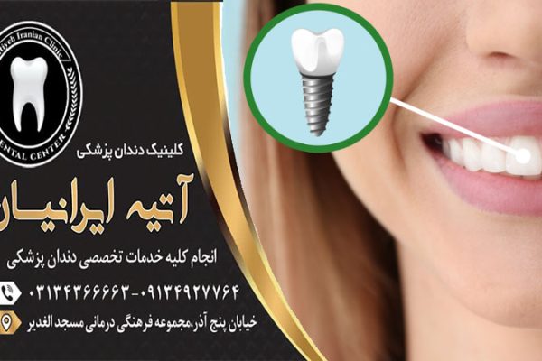 ایمپلنت دندان مناسب چه کسانی است؟