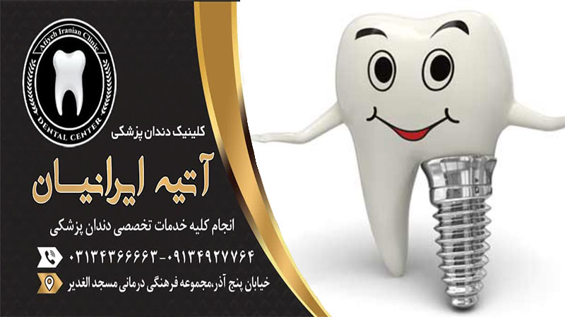 ایمپلنت دندان کودکان