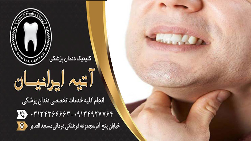 گلو درد پس از عصب کشی دندان