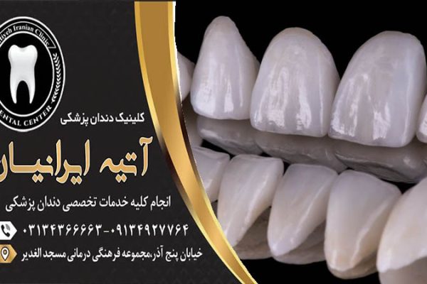 روکش فول سرامیک دندان چیست؟