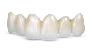 روکش فول سرامیک دندان چیست؟