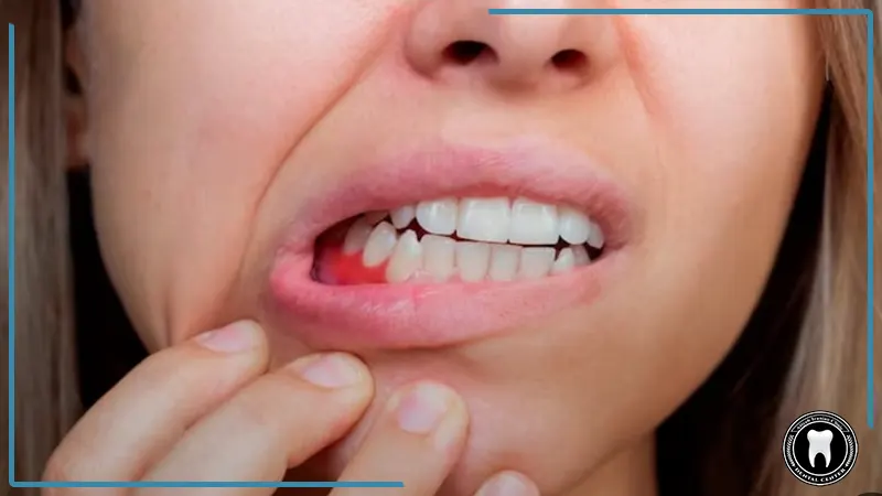روش‌های پیشگیری از بیماری‌های لثه